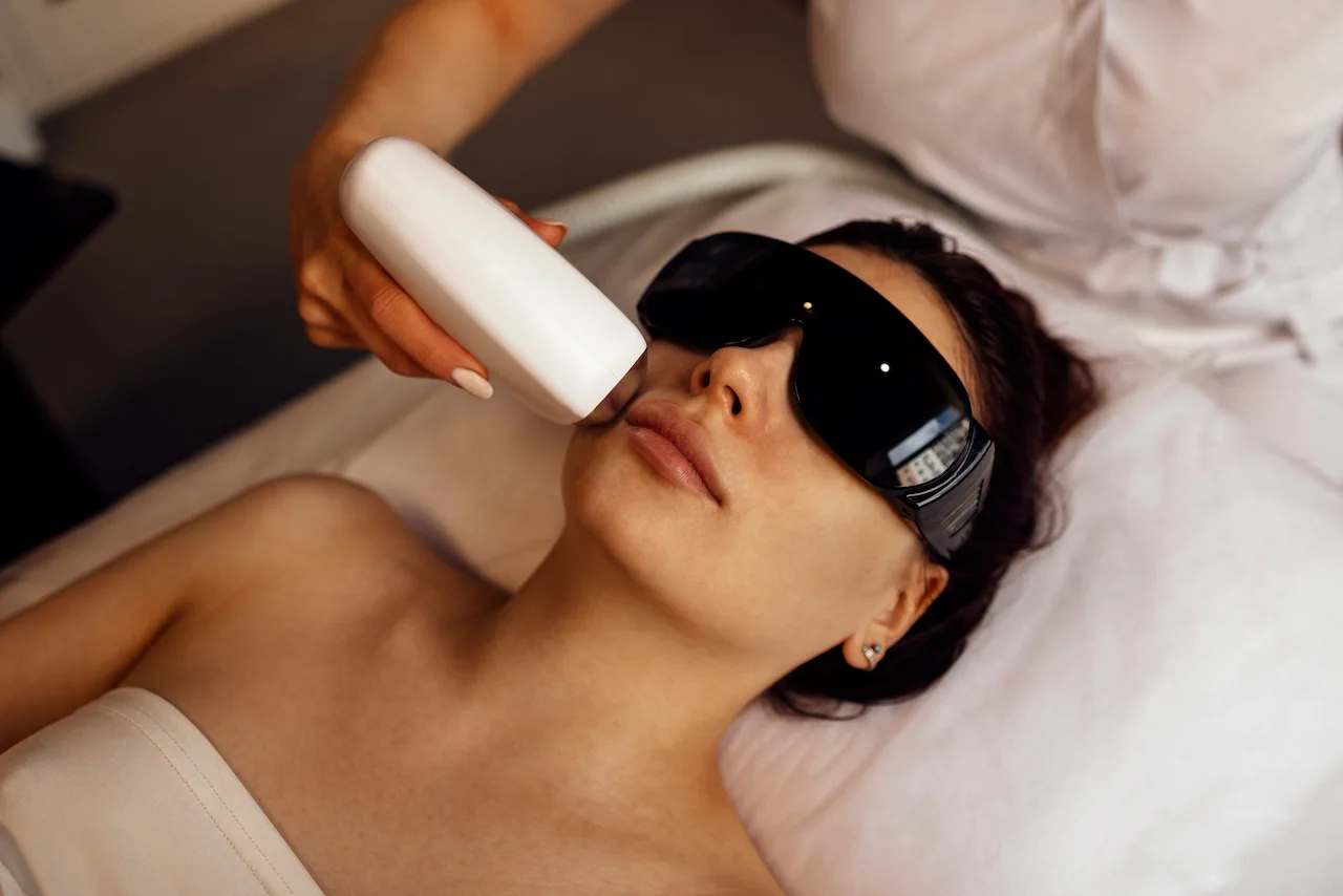 Professionalesthetic Depilación Láser